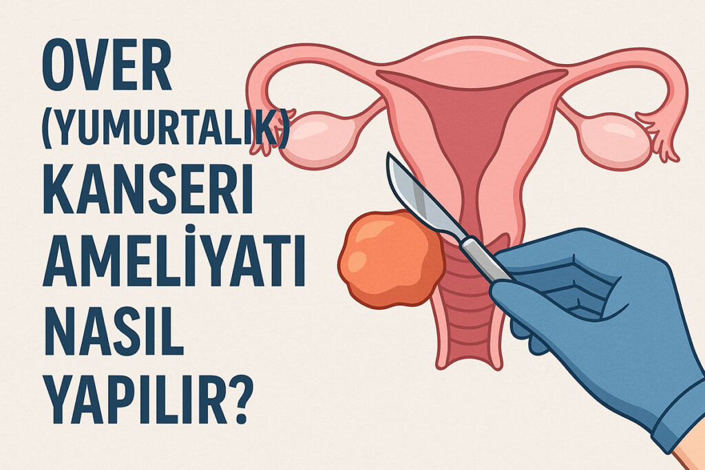 Over (Yumurtalık) Kanseri Ameliyatı Nasıl Yapılır?
