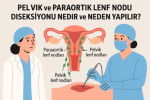 Pelvik ve Paraaortik Lenf Nodu Diseksiyonu Nedir ve Neden Yapılır?