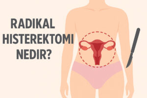 Radikal histerektomi nedir?