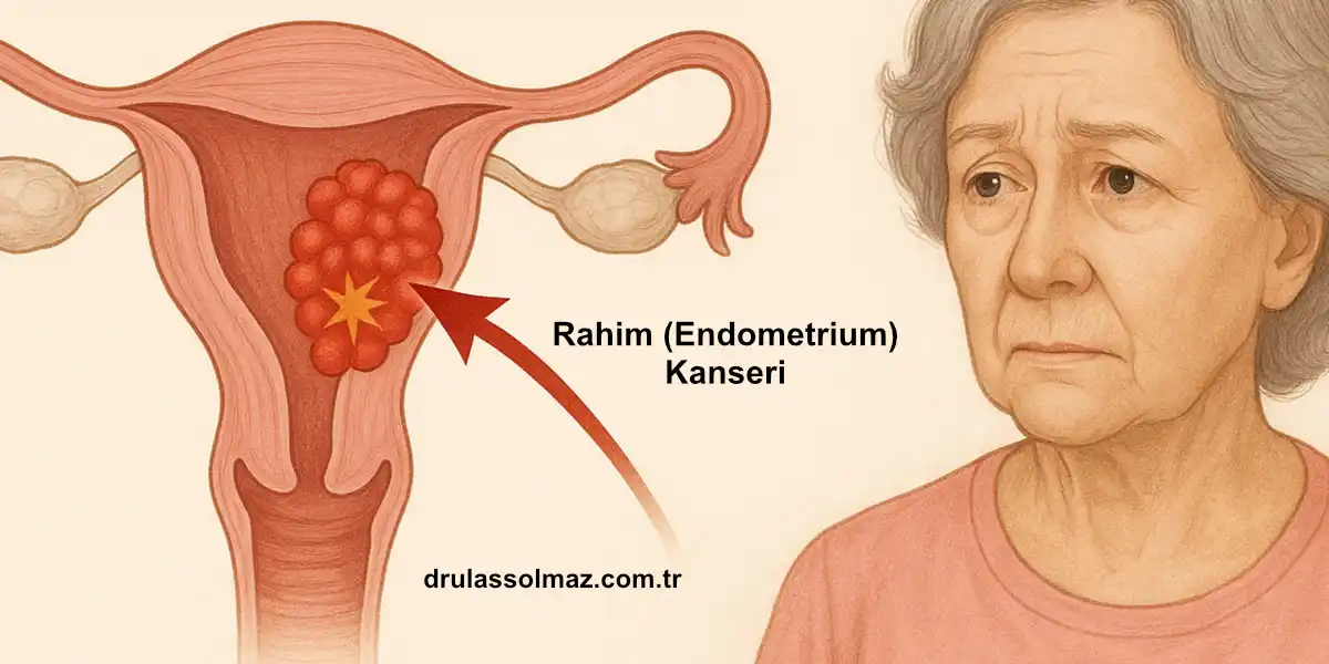 Rahim (Endometrium) Kanseri; Belirtileri, Nedenleri ve Tedavisi