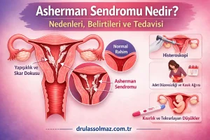 Asherman Sendromu Nedir? Nedenleri, Belirtileri ve Tedavisi