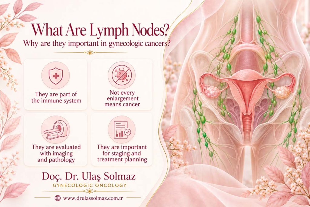 What Are Lymph Nodes? Why Are They Important in Gynecologic Cancers?